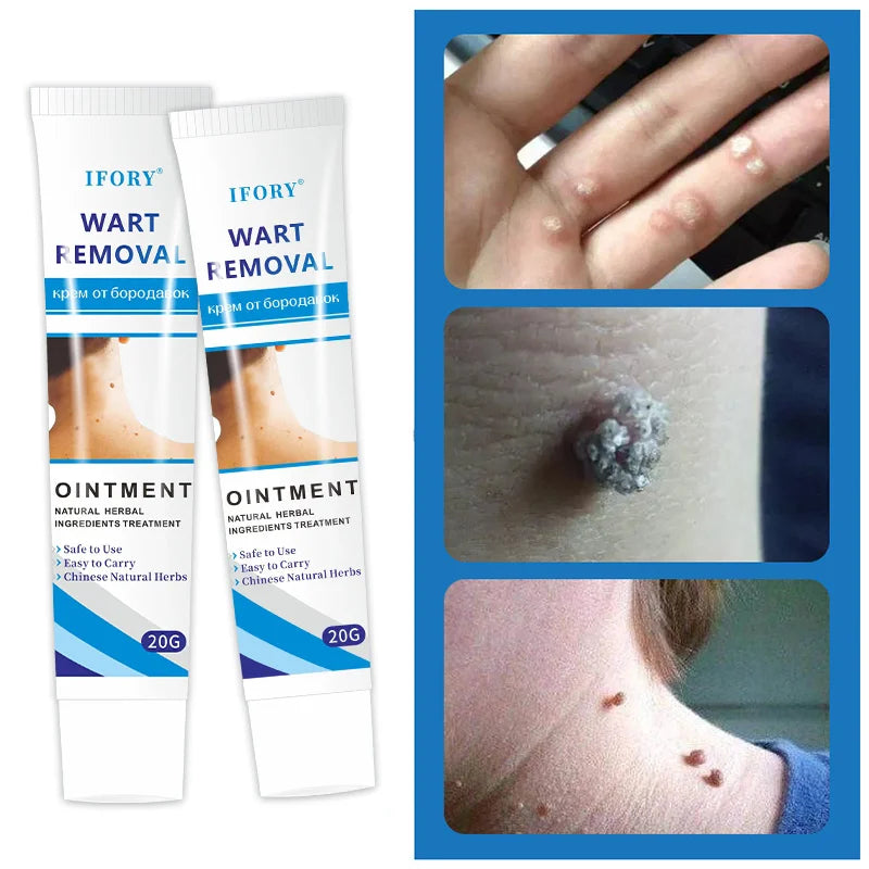 WartsOff Instant Blemish Removal Cream Warts Off Instant Blemish Removal Cream 20 g Wart Remover Ointment for All Skin Types (Pack of 1)