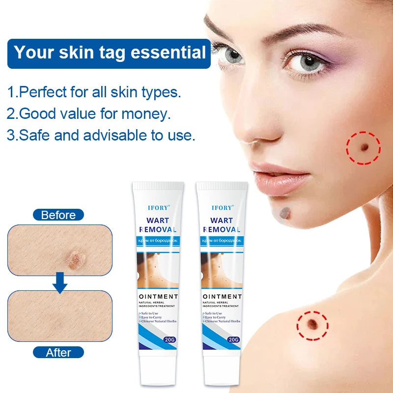 WartsOff Instant Blemish Removal Cream Warts Off Instant Blemish Removal Cream 20 g Wart Remover Ointment for All Skin Types (Pack of 1)